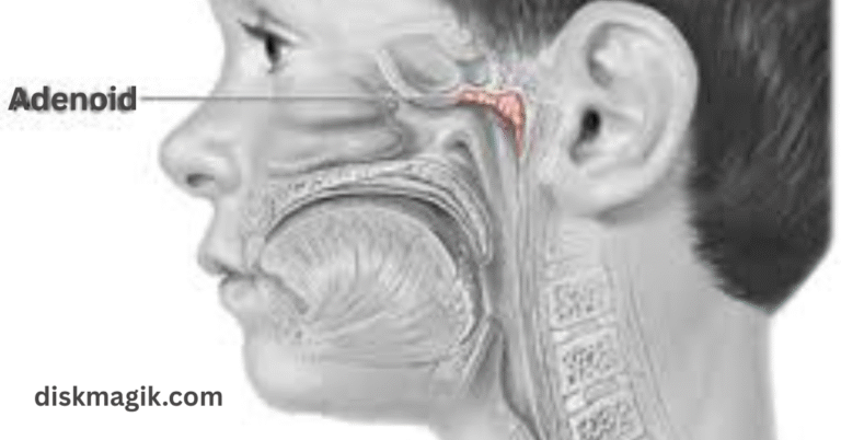 Adenoidid