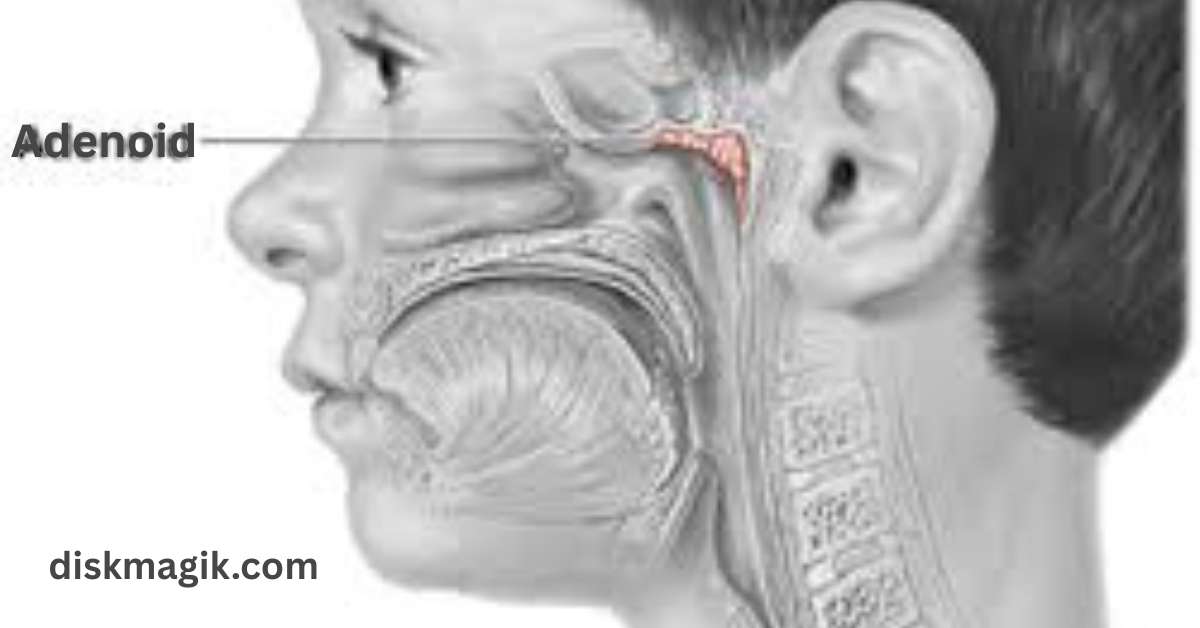 Adenoidid